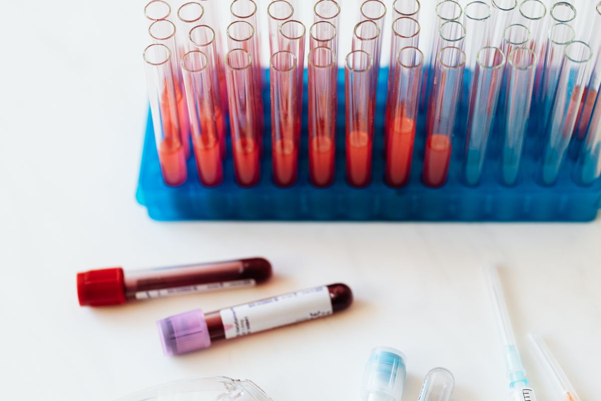 Skúmavky na laboratórne vyšetrenie krvi